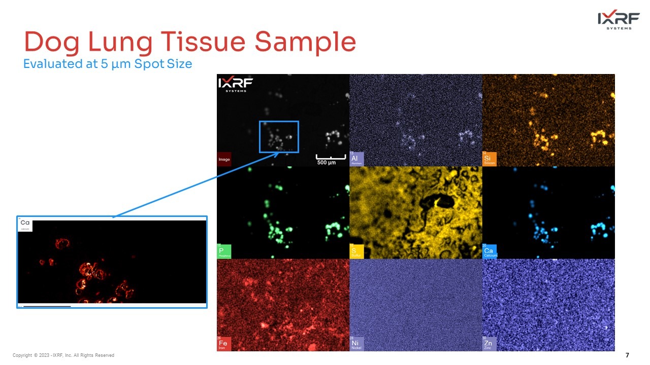 Dog lung tissue sample Laboratory-based MicroXRF elemental maps show the distribution of Si, P, S, Ca, and Fe